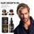 EAA03-A015-30-BK2-002.jpg East Moon Hair Treatment – Hair Growth (3) - Product detail