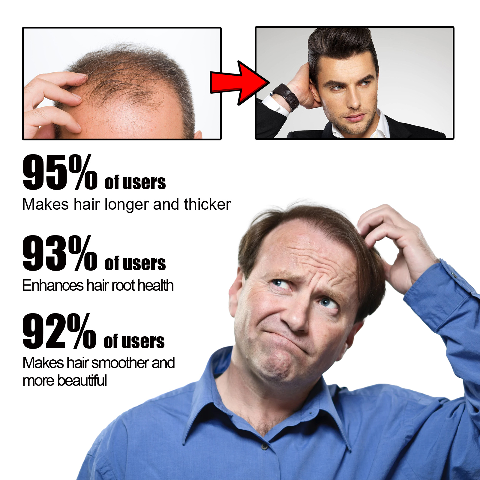 Female hair loss treatment plan minoxidil and spironolactone