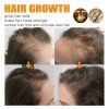 EELHOE Professional Hair Care Product #270