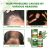 EEA06-A060-60-GN1-003.jpg EELHOE Hair Treatment – Hair Growth - Product in use