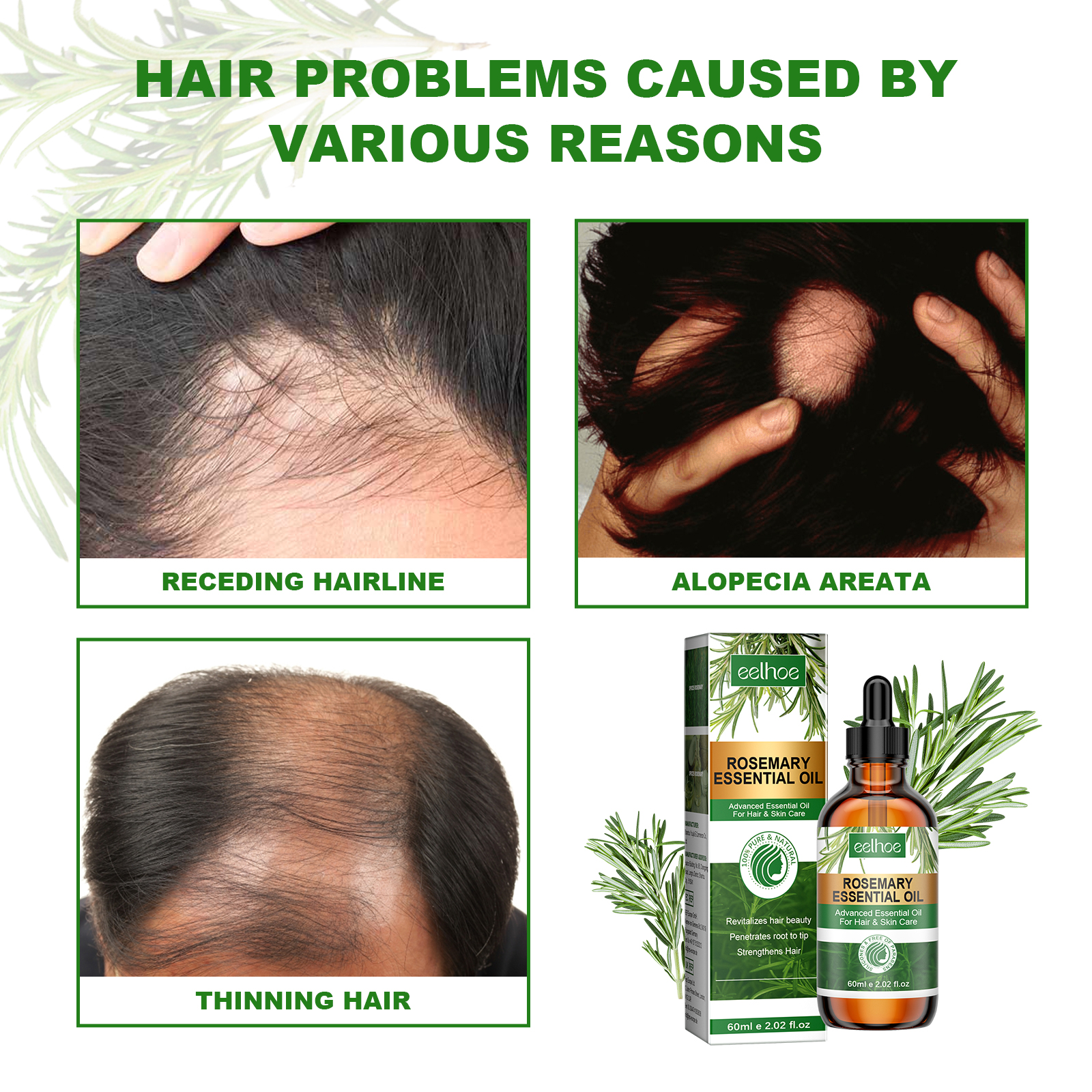 Minoxidil 5% Foam vs Liquid: Which Format Works Better for Women’s Hair Loss?