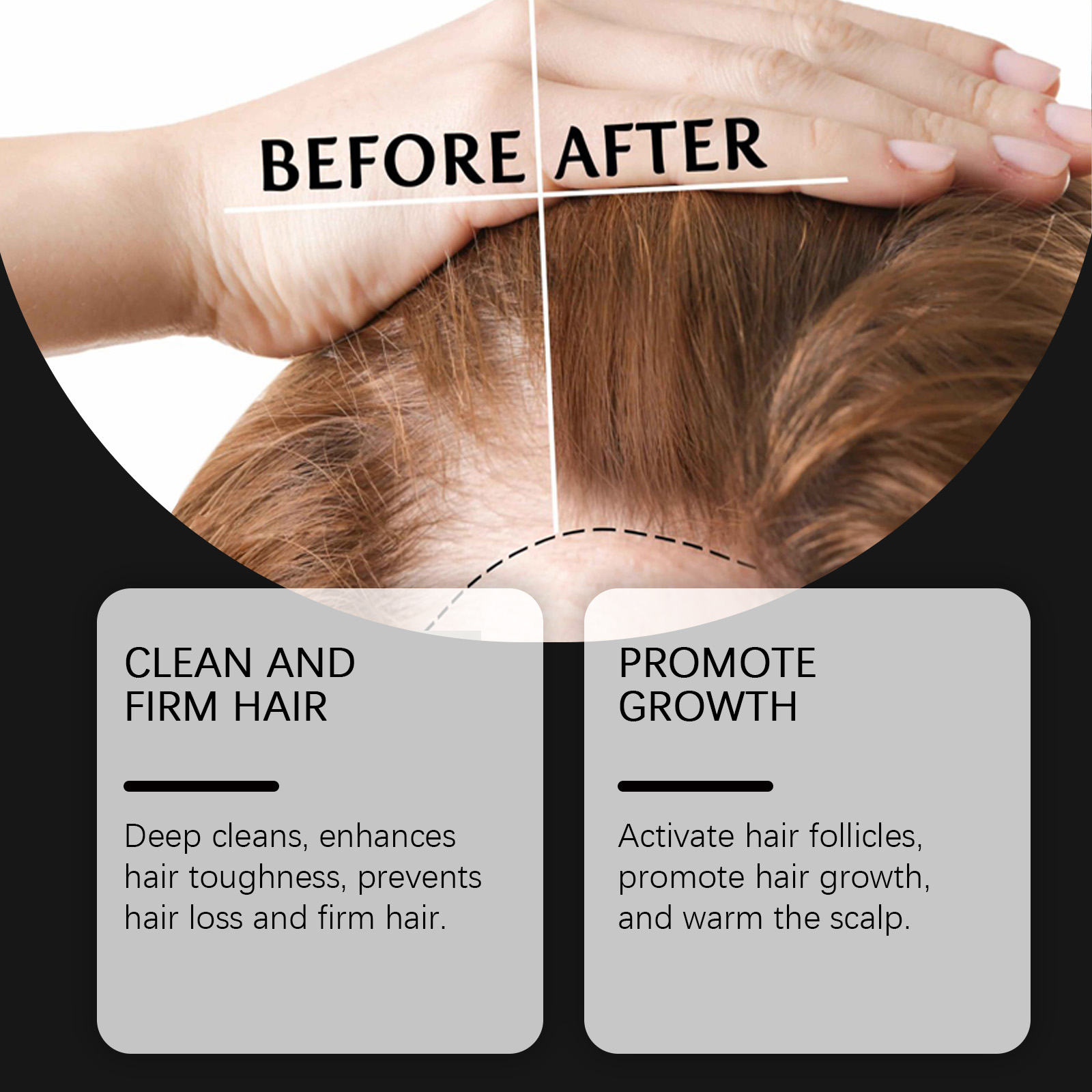 Hoegoa Shampoo shampoo repair scalp 100ml | Premium Hair Care - Image 4