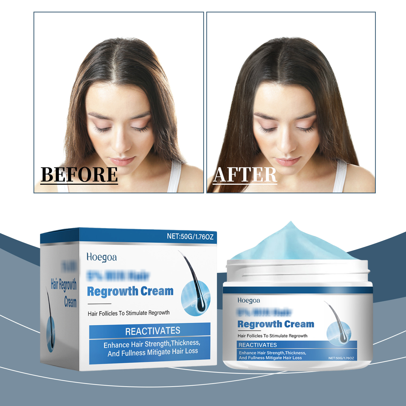 prepare for your first dermatologist visit for hair loss results and when to seek professional help