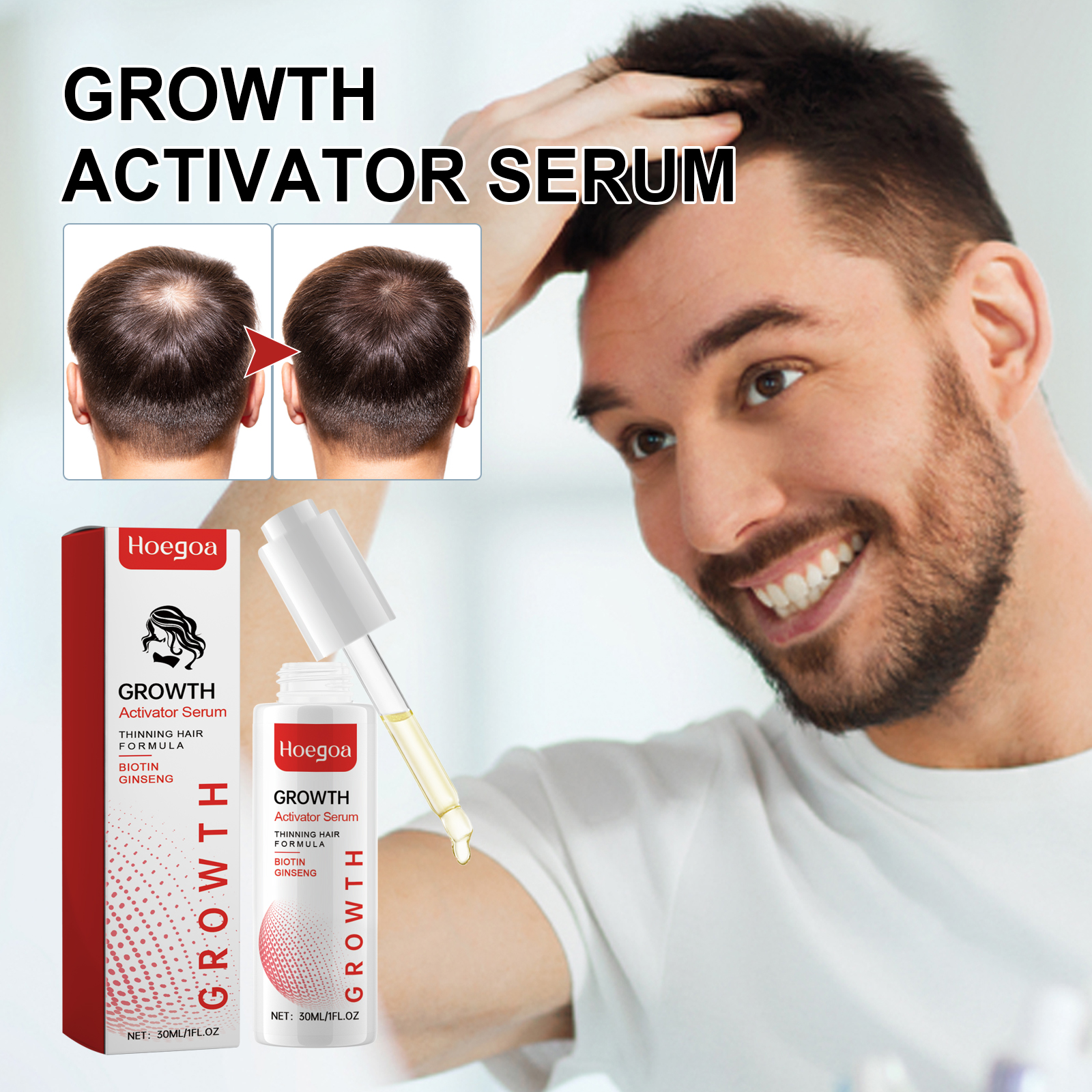 Iron supplementation protocol for hair health and ferritin monitoring
