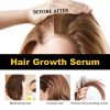 HGA03-A019-30-BK1-004.jpg Hoegoa Professional Hair Care Product #260