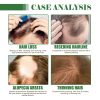 Hoegoa Professional Hair Care Product #259