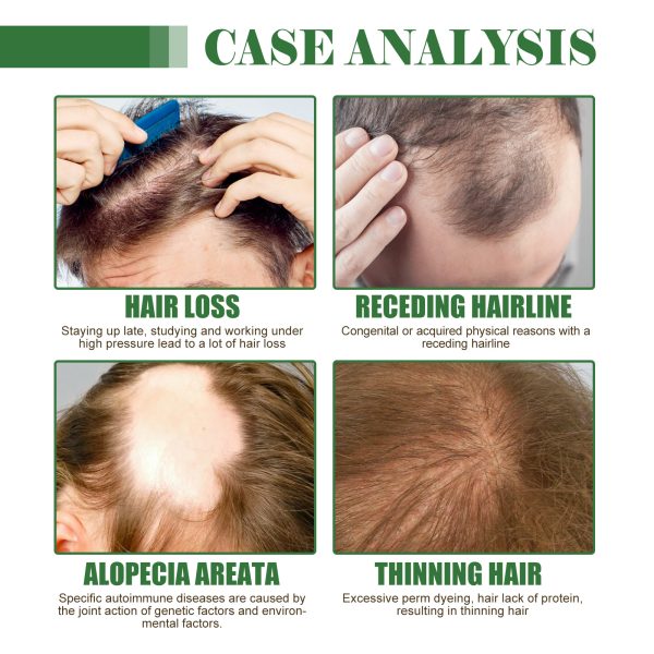 Hoegoa Professional Hair Care Product #259