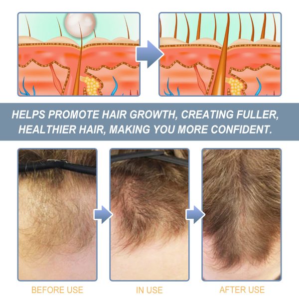 HGA03-A046-100-WH1-004.jpg Hoegoa Professional Hair Care Product #241