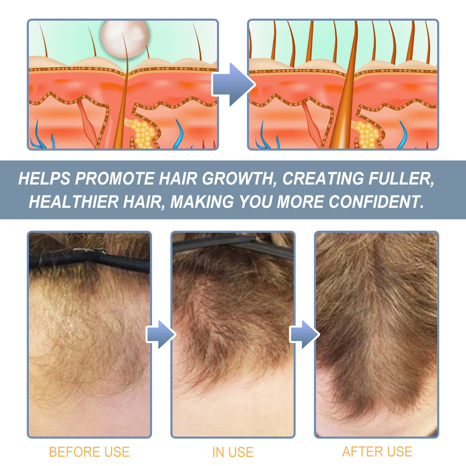 Vitamin D supplementation and hair loss clinical study results