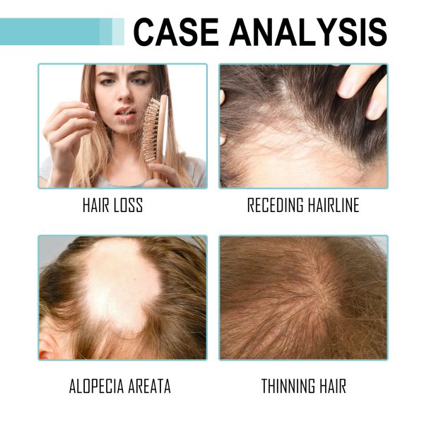 Hoegoa Professional Hair Care Product #238