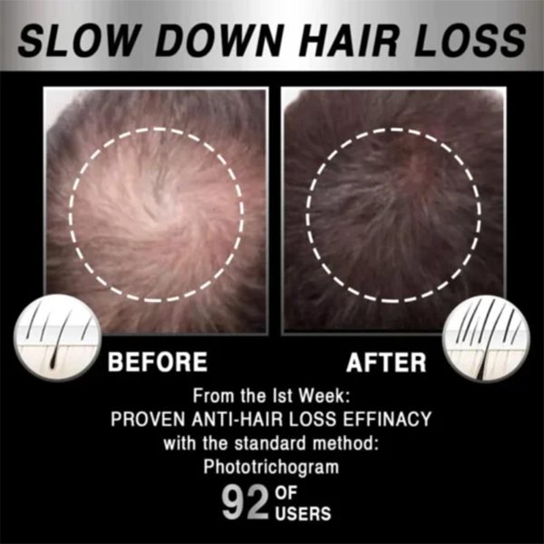 Hoegoa Professional Hair Care Product #235