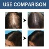 HGA03-A089-30-BU1-003.jpg Hoegoa Professional Hair Care Product #222