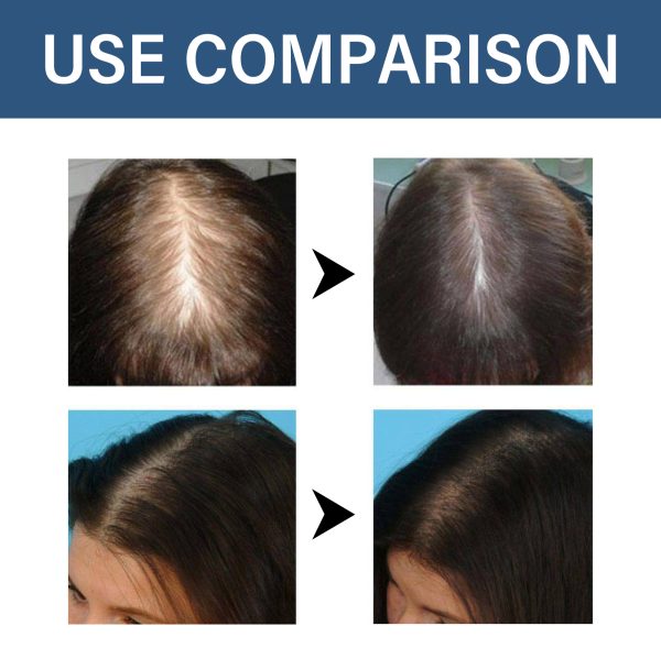 HGA03-A089-30-BU1-003.jpg Hoegoa Professional Hair Care Product #222
