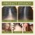 Hoegoa Hair Treatment – Strengthening & Moisturizing (14) - Packaging