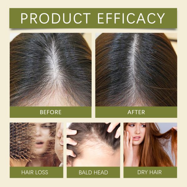 HGA03-A107-30-GN1-004.jpg Hoegoa Professional Hair Care Product #216