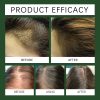HGA03-A110-100-GN1-004.jpg Hoegoa Professional Hair Care Product #213