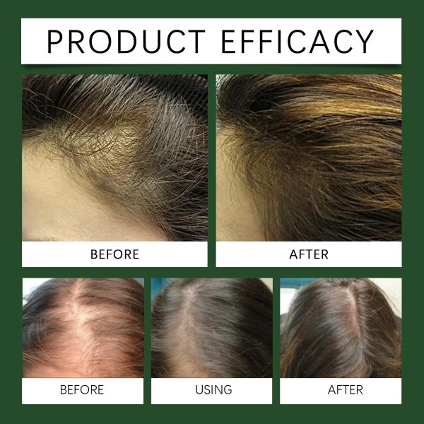 HGA03-A110-100-GN1-004.jpg Hoegoa Professional Hair Care Product #213
