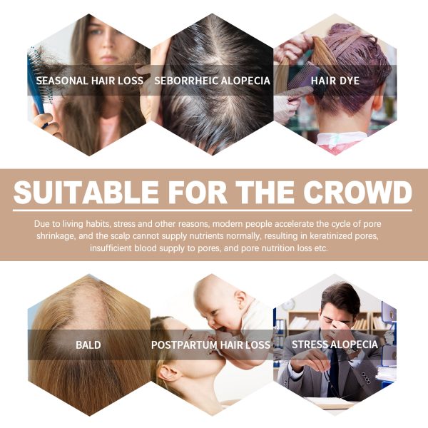 OUHOE Professional Hair Care Product #278