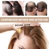OUHOE Professional Hair Care Product #278