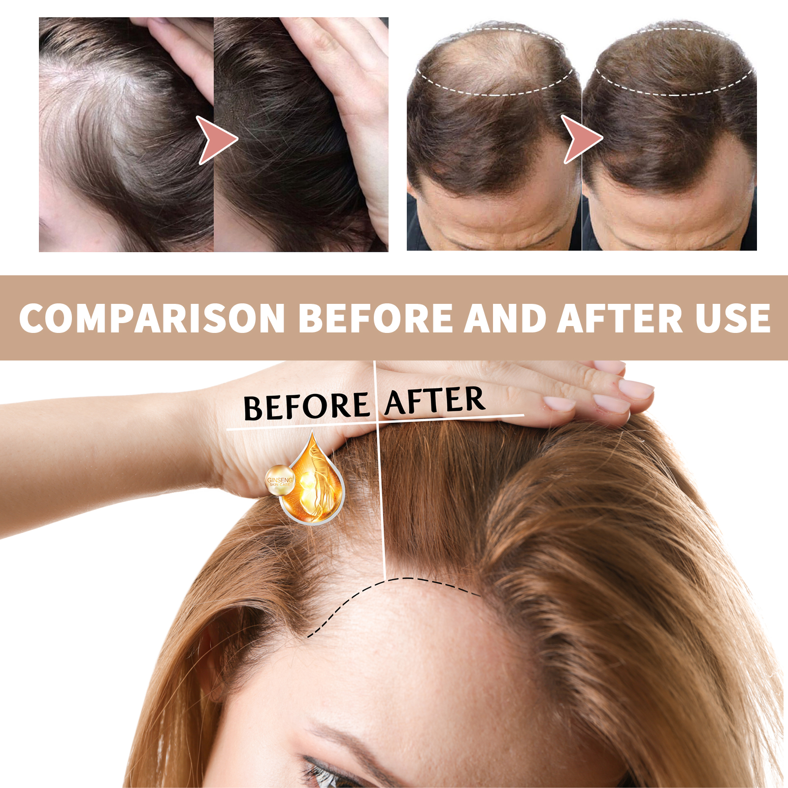 Castor oil application methods and dilution guide for hair