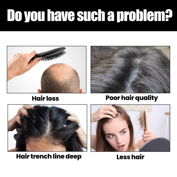 OUHOE Professional Hair Care Product #291
