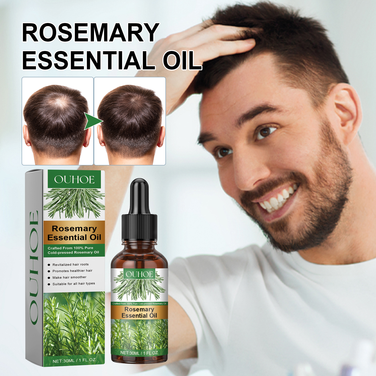 PRP treatment cost comparison with other hair loss treatments