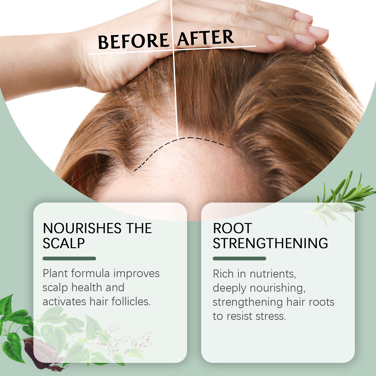 PRP therapy results after four sessions hair density improvement