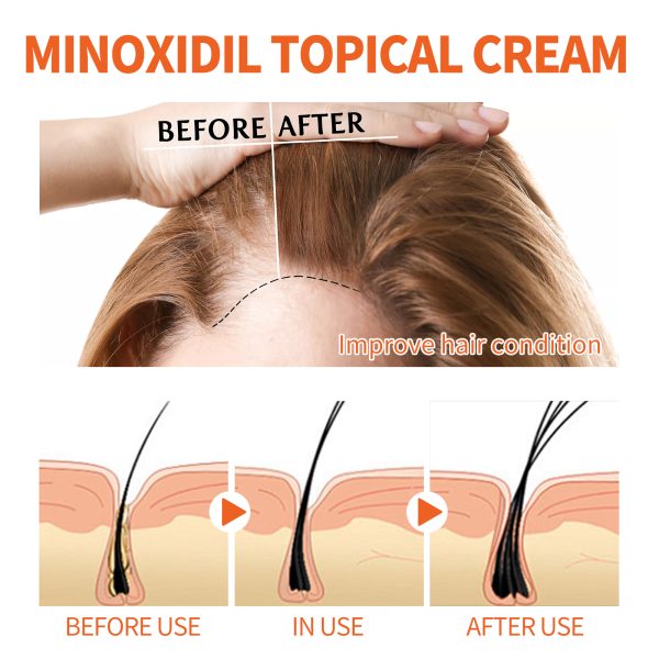 WYA03-A006-30-BU1-004.jpg Wiyun Professional Hair Care Product #230