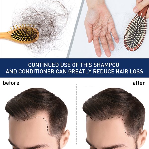 Ximonth Professional Hair Care Product #250