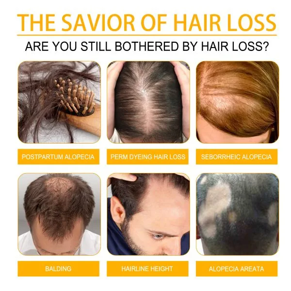 Hair Styling Treatment | EELHOE 30ml