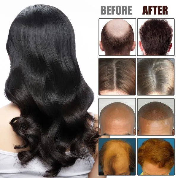 Scalp Treatment | EELHOE 50ml