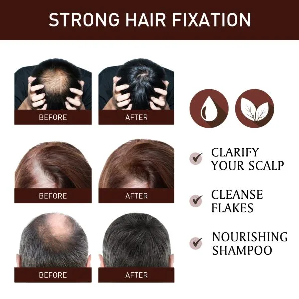 Scalp Treatment | EELHOE 50ml