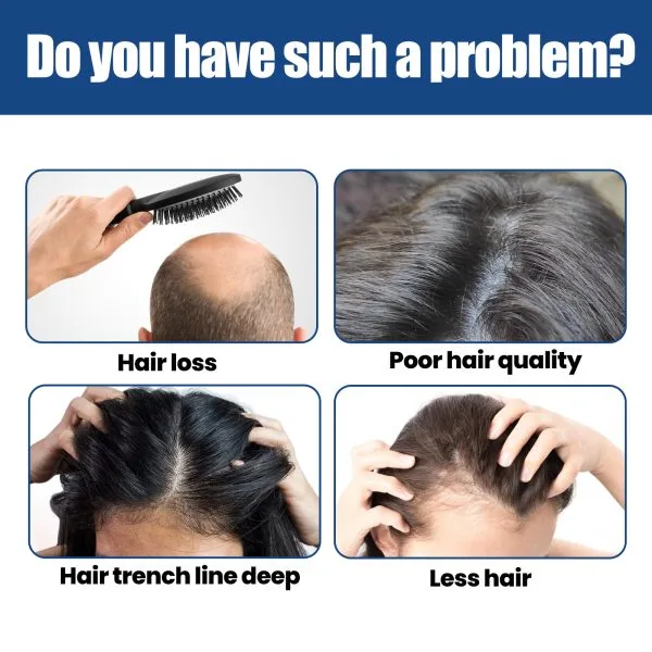 Scalp Treatment | JAYSUING 60ml