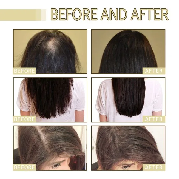 Scalp Treatment | JAYSUING 60ml