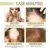 Scalp Treatment | JAYSUING 60ml