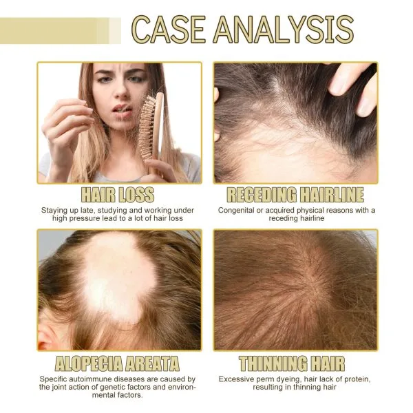 Scalp Treatment | JAYSUING 60ml