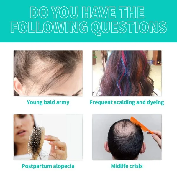 Scalp Treatment | OUHOE 18ml