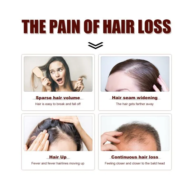 Anti Hair Loss Shampoo | OUHOE 100ml