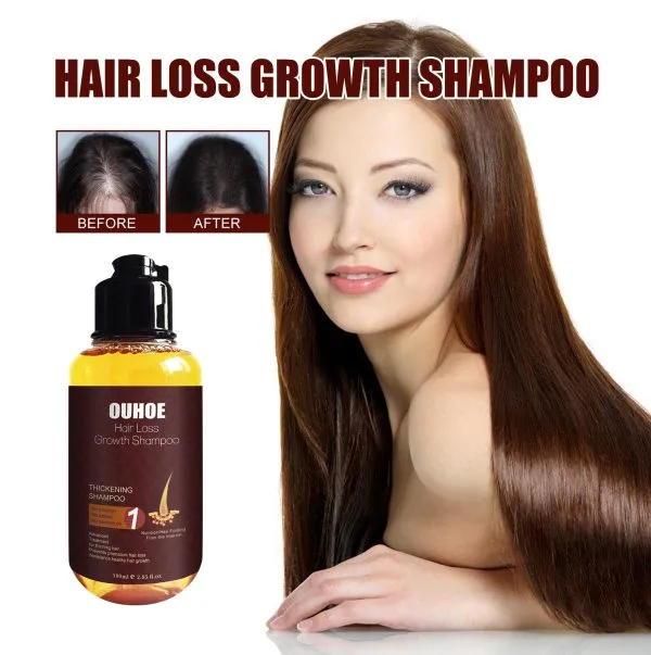 Anti Hair Loss Shampoo | OUHOE 100ml