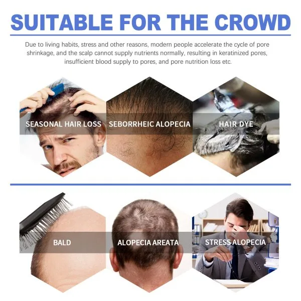 Scalp Treatment | OUHOE 60ml