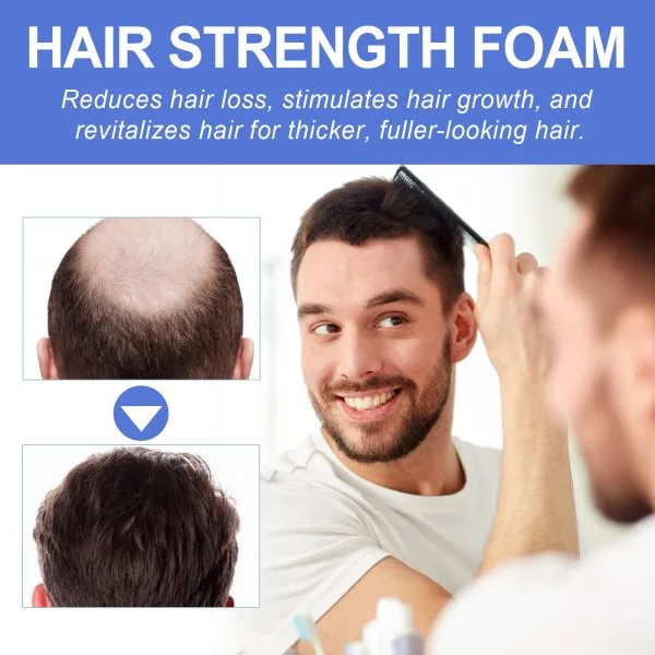 Scalp Treatment | OUHOE 60ml