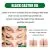 Scalp Treatment | OUHOE 60ml