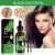 Scalp Treatment | OUHOE 60ml
