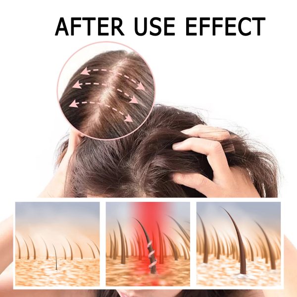 East Moon Serum Hair Strengthening 1set - product photo 4