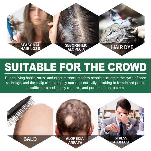 Panthenol & Alcohol Anti Hair Loss Treatment | East 100ml