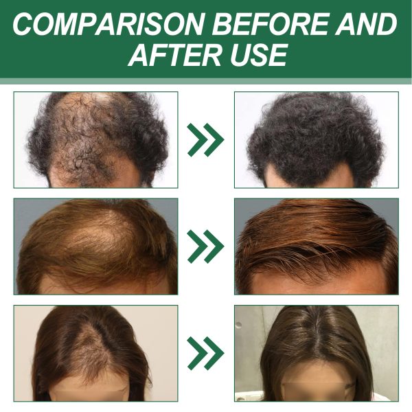 East Moon Spray Hair Strengthening 100ml - product photo 4
