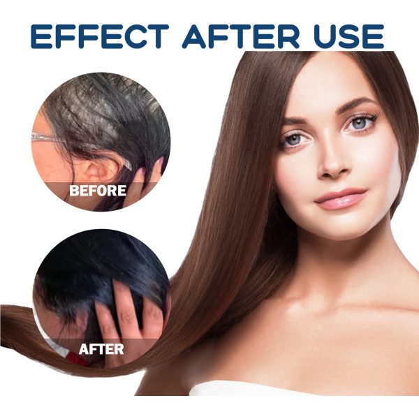 East Moon Spray Hair Strengthening 30ml - product photo 4