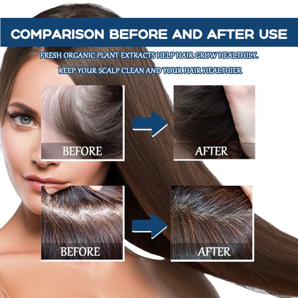 Ginseng & Ginger Anti Hair Loss Treatment | East 30ml