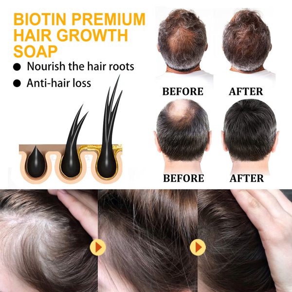 Biotin & Glycerin Scalp Treatment | EELHOE 1pcs