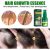EELHOE Ginger Spray Nourishing 30ml/ front view